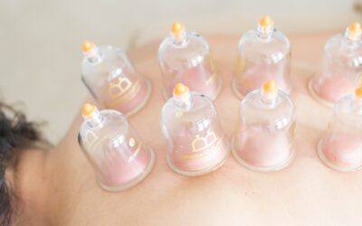 The Benefits of Cupping: A Holistic Healing Therapy
